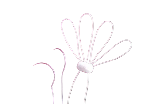SERAMON Chordae Loops Mitral Valve Repair Sutures