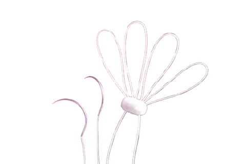 SERAMON Chordae Loops Mitral Valve Repair Sutures